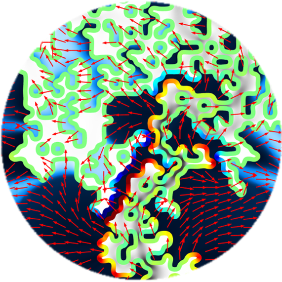 <p>Mathematical modeling quantifies increased movement of drug molecules and of interstitial fluids that bathe cells and can circulate drug molecules that have crossed out of the bloodstream and into brain tissue spaces. Credit: Massachusetts General Hospital / Georgia Tech / Arvanitis / Askoxylakis</p>