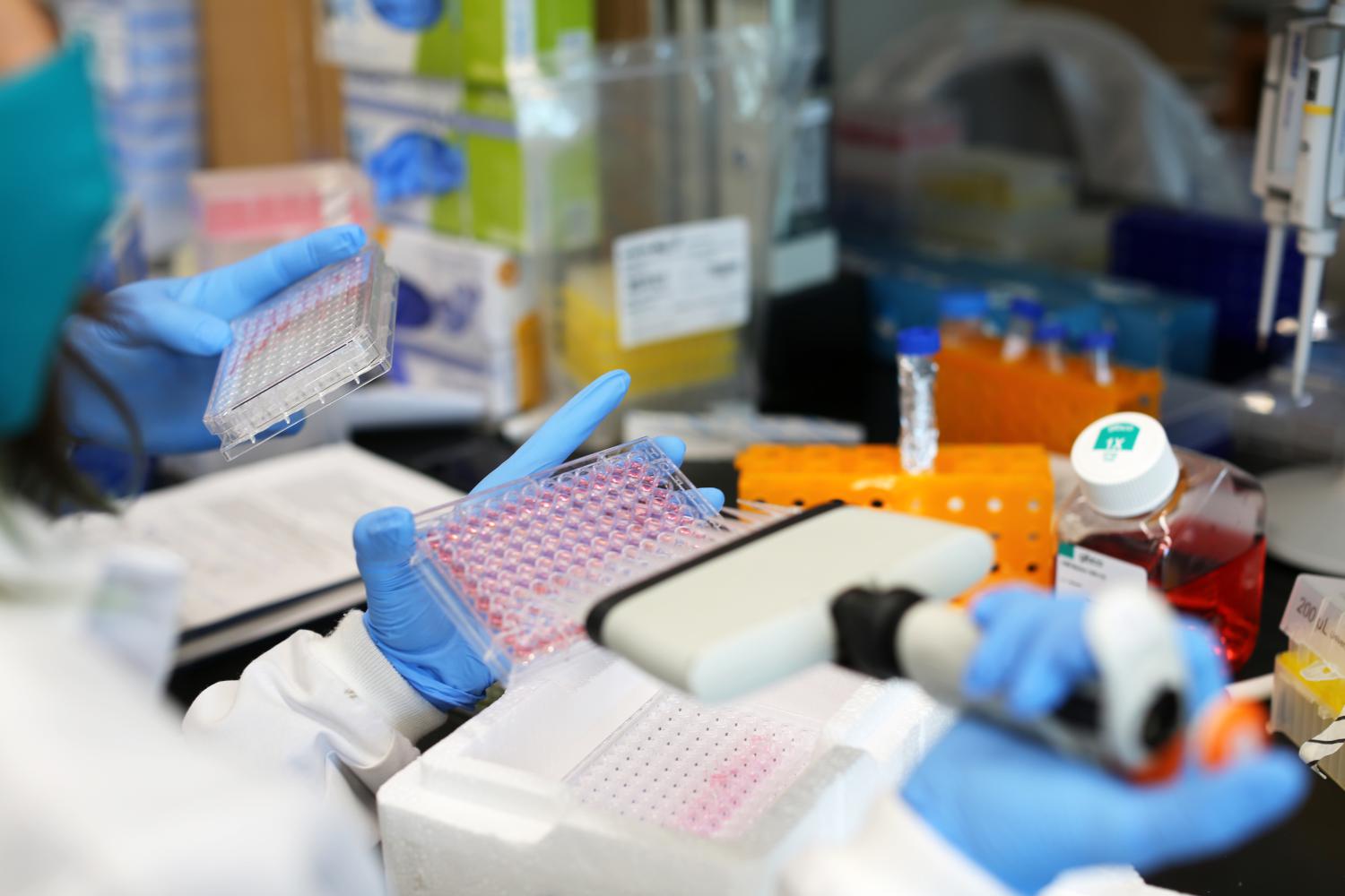 Gloved hands pipetting samples in a lab environment.