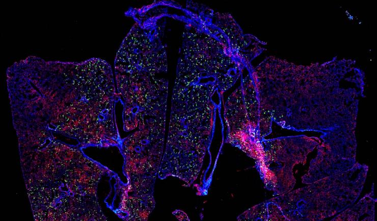 <p>Stitched confocal microscopy image of RSV-infected mouse lung. RSV nucleoprotein and fusion proteins appear red and green, respectively. Cell nuclei appear blue.</p>