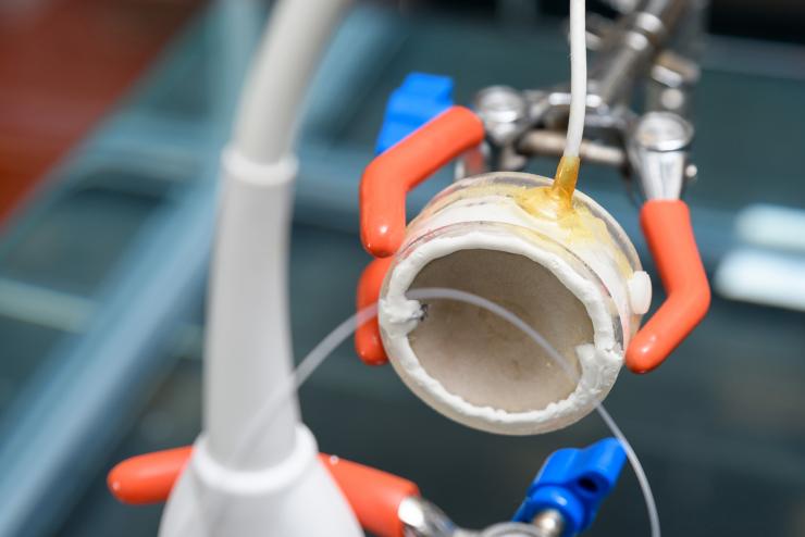 <p>The parabolic shape helps researchers focus ultrasound energies to concentrate them on an area. This is a set-up in Costas Arvanitis's Georgia Tech lab to test the device and not part of a treatment or experiment. Credit: Georgia Tech / Rob Felt</p>