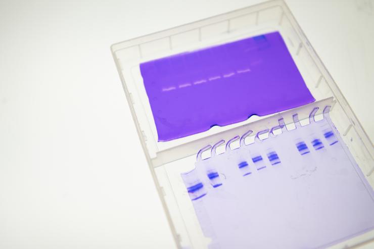 <p>Cathepsins eat away at collagen and elastin in Manu Platt's Georgia Tech lab. Credit: Georgia Tech / Allison Carter</p>