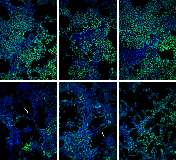 <p>Image shows colony patterning and morphology after 24 and 48 hours of retinoic acid exposure, respectively, with adenylyl cyclase or gap junction inhibition compared to the vehicle control.  (Credit: Chad Glen, Georgia Tech)</p>