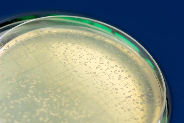 <p>Image shows a petri dish with yeast colonies that survived DNA breakage by Rad52-guided inverse RNA strand exchange. (Credit: Rob Felt, Georgia Tech)</p>