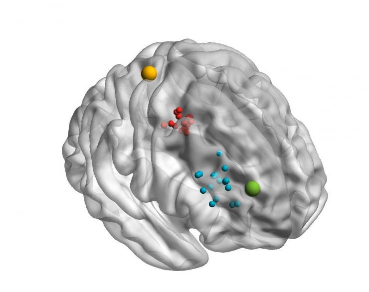 <p>When temporary magnetic stimulation was applied to target areas of the brain, it affected the way test subjects performed aspects of visual tasks.</p><p> </p>