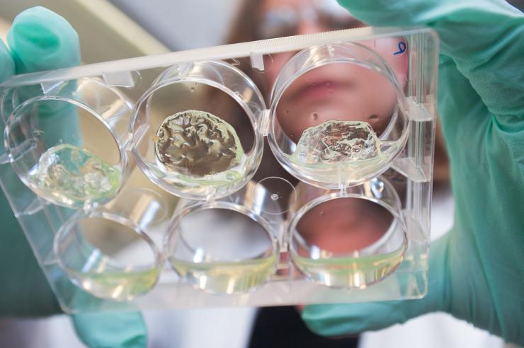 <p>Jessica Weaver, a postdoctoral researcher in Georgia Tech’s Woodruff School of Mechanical Engineering, holds a multiwall plate containing hydrogels with pancreatic islet cells. (Credit: Christopher Moore, Georgia Tech)</p>

<p> </p>