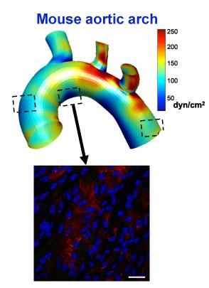 The shear-sensitive gene LMO4 is turned on in the region in the center, but not the other two, because of disturbed flow in that area of the aorta.