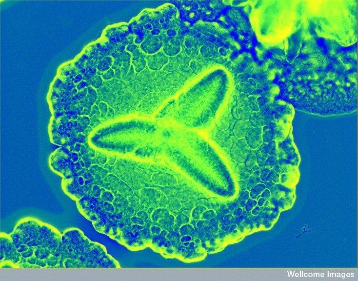 <p>Bacteria behind acute periodontitis. <em>Aggregatibacter actinomycetemcomitans</em> most often lives peacefully in the mouth until circumstances lead it to become infectious. It forms flower-like colonies, here under a microscope sporting a colorful stain added by a researcher. Aa is gram-negative. Credit: Derren Ready (2012) CIL:38942, CIL. Dataset. https://doi.org/doi:10.7295/W9CIL38942 Creative Commons license</p>