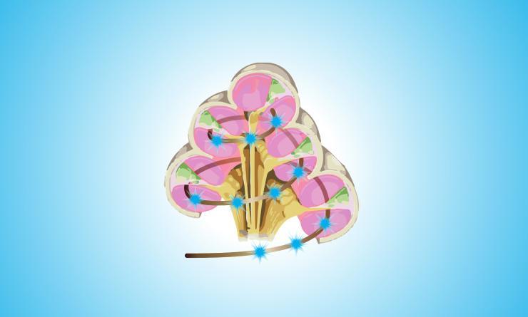 Schematic of CORTIORGAN flexible optical implant in cochlea with individually addressed blue LEDs. Cross-section cut-outs in schematic show path of implant inside cochlea. Credit: GT-Lorraine