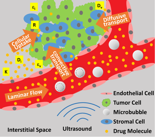 <p>An illustration of improved delivery of anti-cancer drugs to malignancies in the brain. On the left half, focused ultrasound agitates microbubbles, which breach the blood-brain barrier, allowing drug molecules to get through. The forces also stir interstitial fluid to circulate the drug, and they also encourage the drug to cross cell membranes more easily into tumor cells. Credit: Massachusetts General Hospital / Georgia Tech / Arvanitis / Askoxylakis</p>