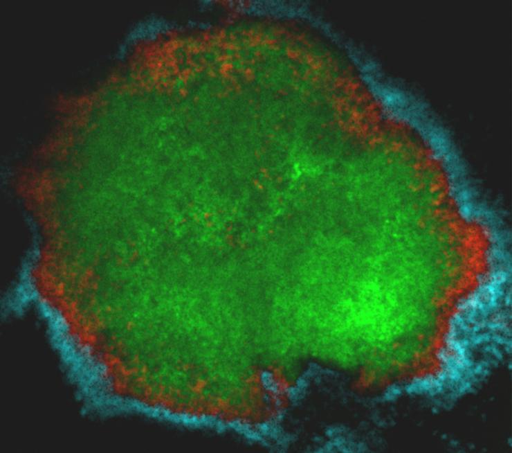 With powerful microscopy, researchers were able to visualize the structure of a tooth decay-causing biofilm growing on toddlers’ teeth. The organism primarily responsible for cavities, Streptococcus mutans, labeled in green, shields itself under layers of other bacteria, enabling it stick stubbornly to the enamel. (Image: Dongyeop Kim)