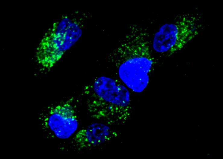 <p>Image shows activation of “AND” gates in cells as observed by fluorescence microscopy. (Credit: Chiara Zurla, Georgia Tech)</p>