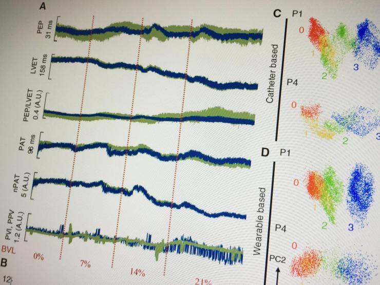 Researchers have shown that they can accurately assess blood loss by measuring seismic vibrations in the chest cavity and by detecting changes in the timing of heartbeats. That could lead to development of a smart wearable device that could be carried by ambulance crews and medics and made available in emergency rooms and surgical facilities.