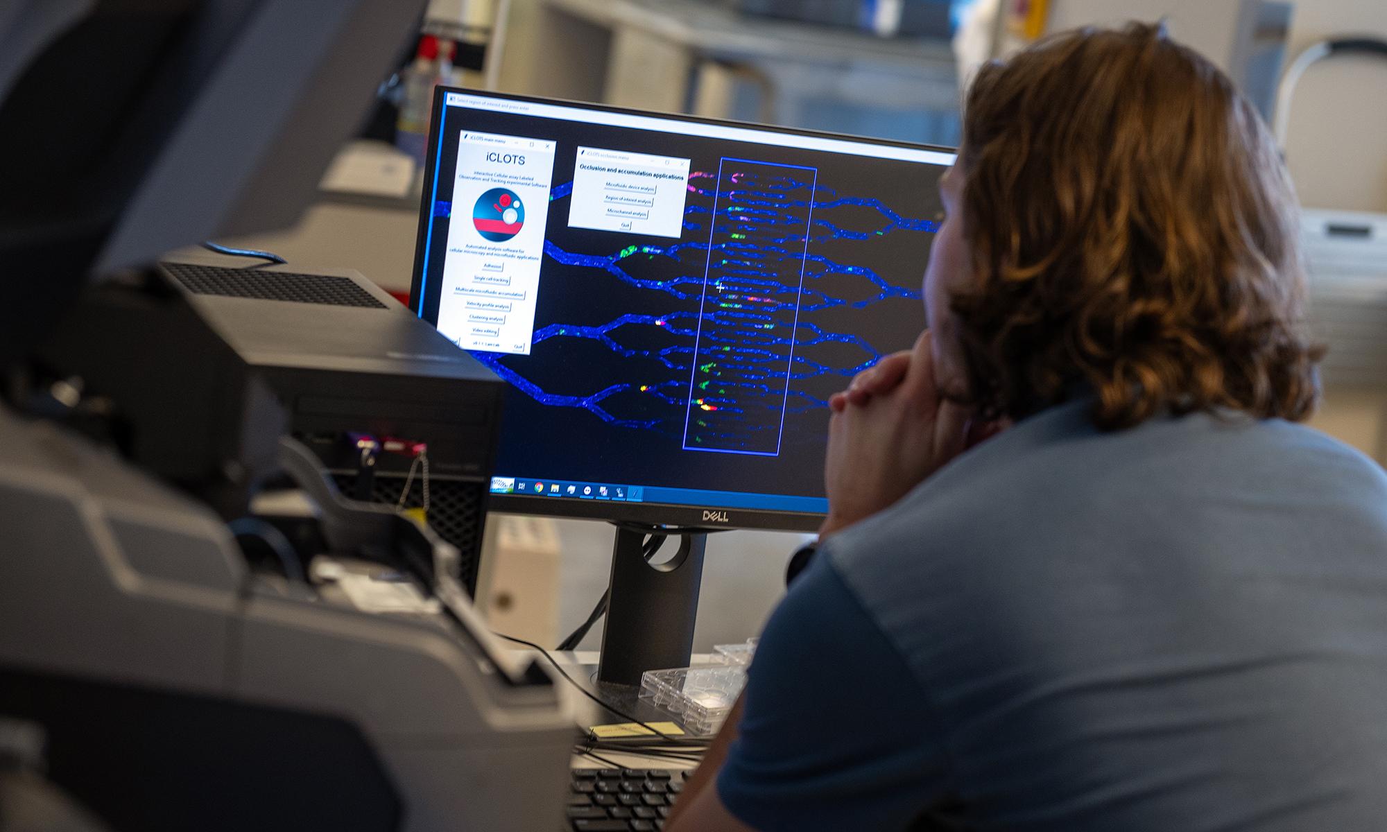 Ph.D. student Kirby Fibben uses the iCLOTS software to analyze an image of a microfluidics chip. (Photo: Candler Hobbs)