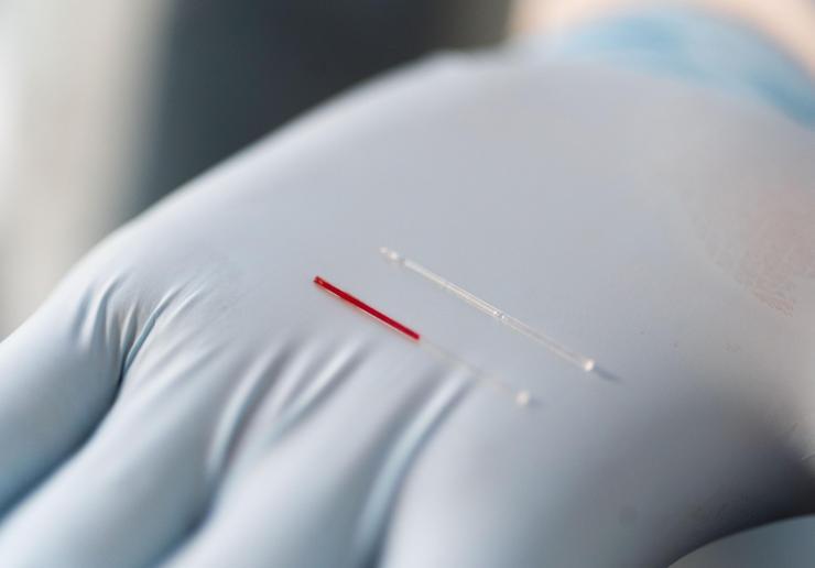 Interstitial fluid (right) may provide an alternative source of biomarkers compared to blood (left) that could be useful in diagnosing human illness. (Credit: Allison Carter, Georgia Tech)