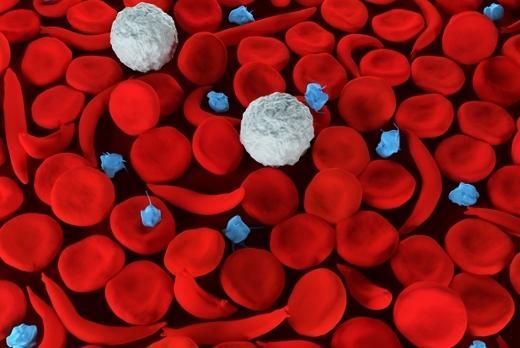 <p>Red blood cells, some of which are sickle cells</p>